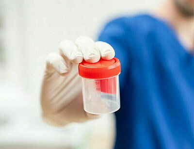 Medizinisches Personal in blauem Kittel hält leeren Behälter für Urinprobe in der Hand