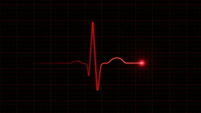 Rote EKG-Kurve vor schwarzem Hintergrund