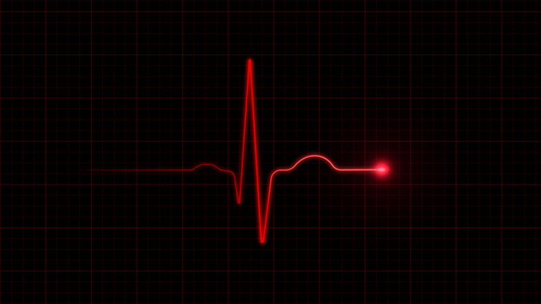 Rote EKG-Kurve vor schwarzem Hintergrund