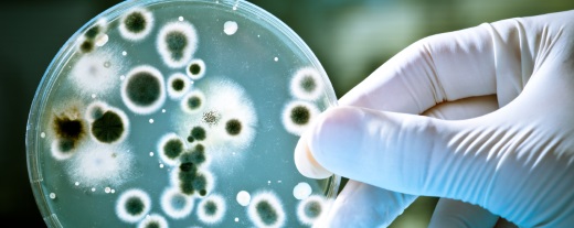 Hand in Einweghandschuhen hält Petrischale mit grünlich gewachsenen Bakterien 