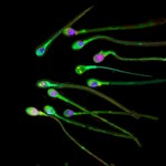 Fluoreszierende Spermien